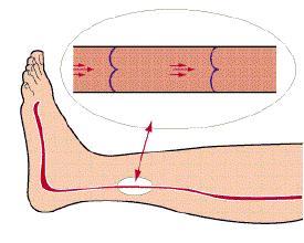 这5类人请立刻停止热水泡脚 盲目泡脚有风险